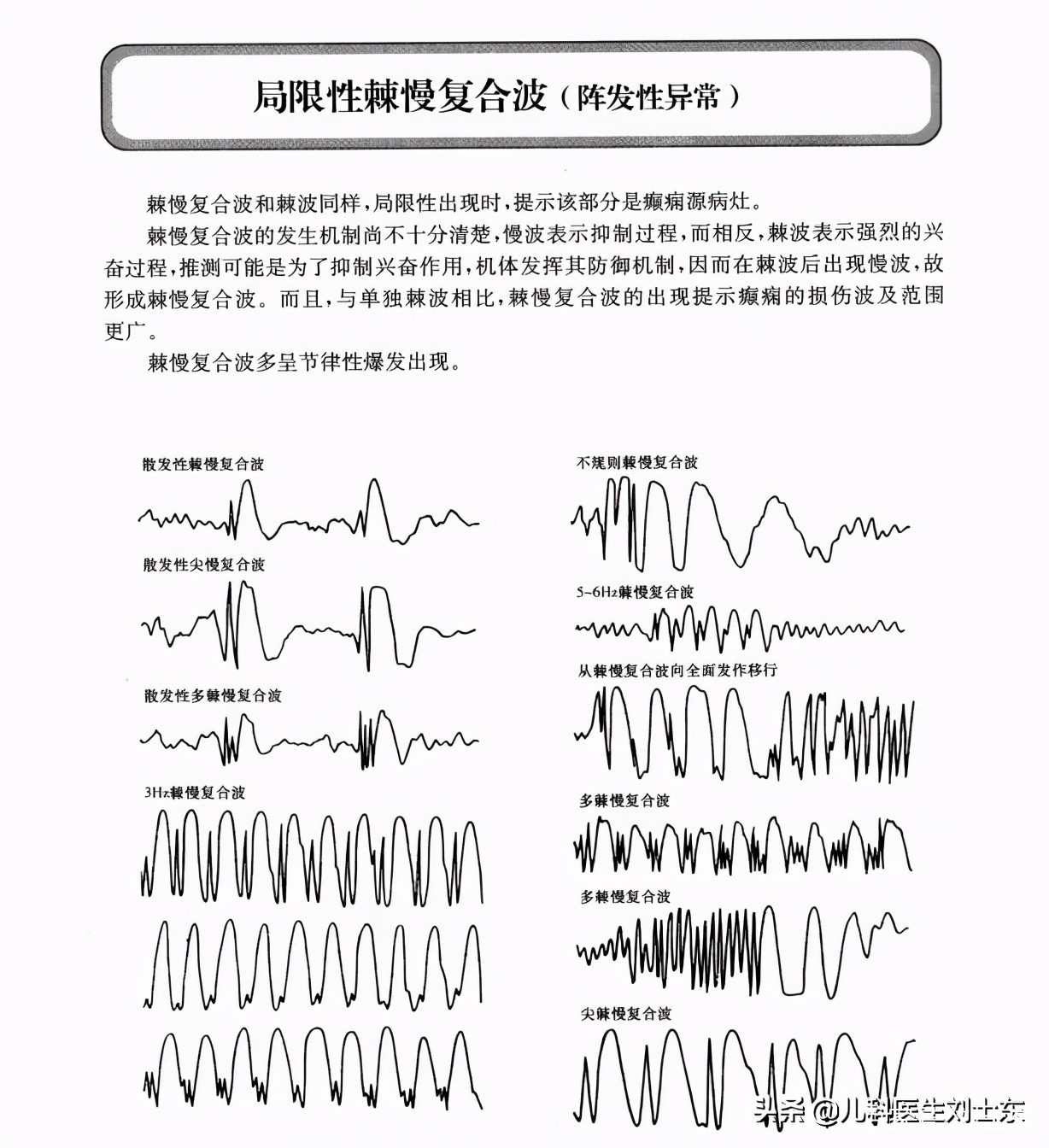 小儿脑电图判读（精述）_复合