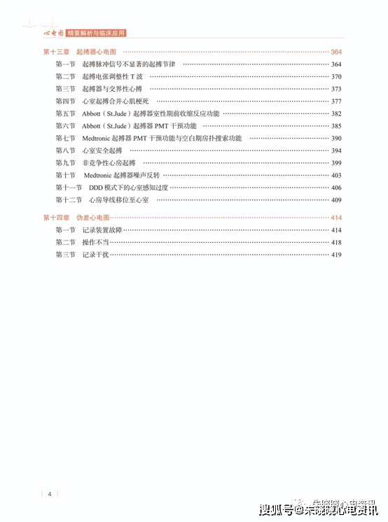 0 mv的倒置t波,常见于心尖部肥厚型心肌病巨大倒置t