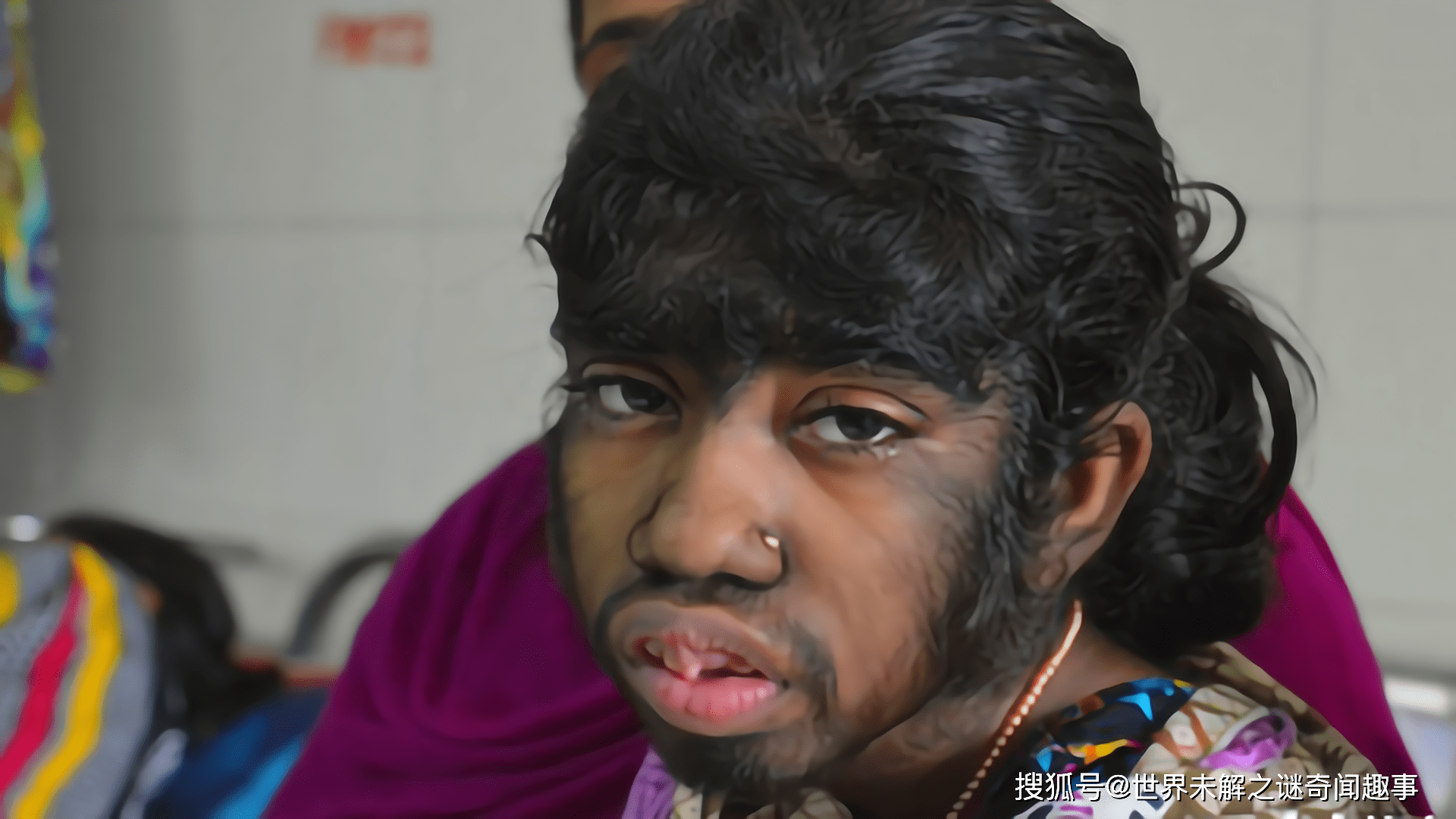 四川少年狼孩生吃猫狗鸟蛇医生造访给出答案