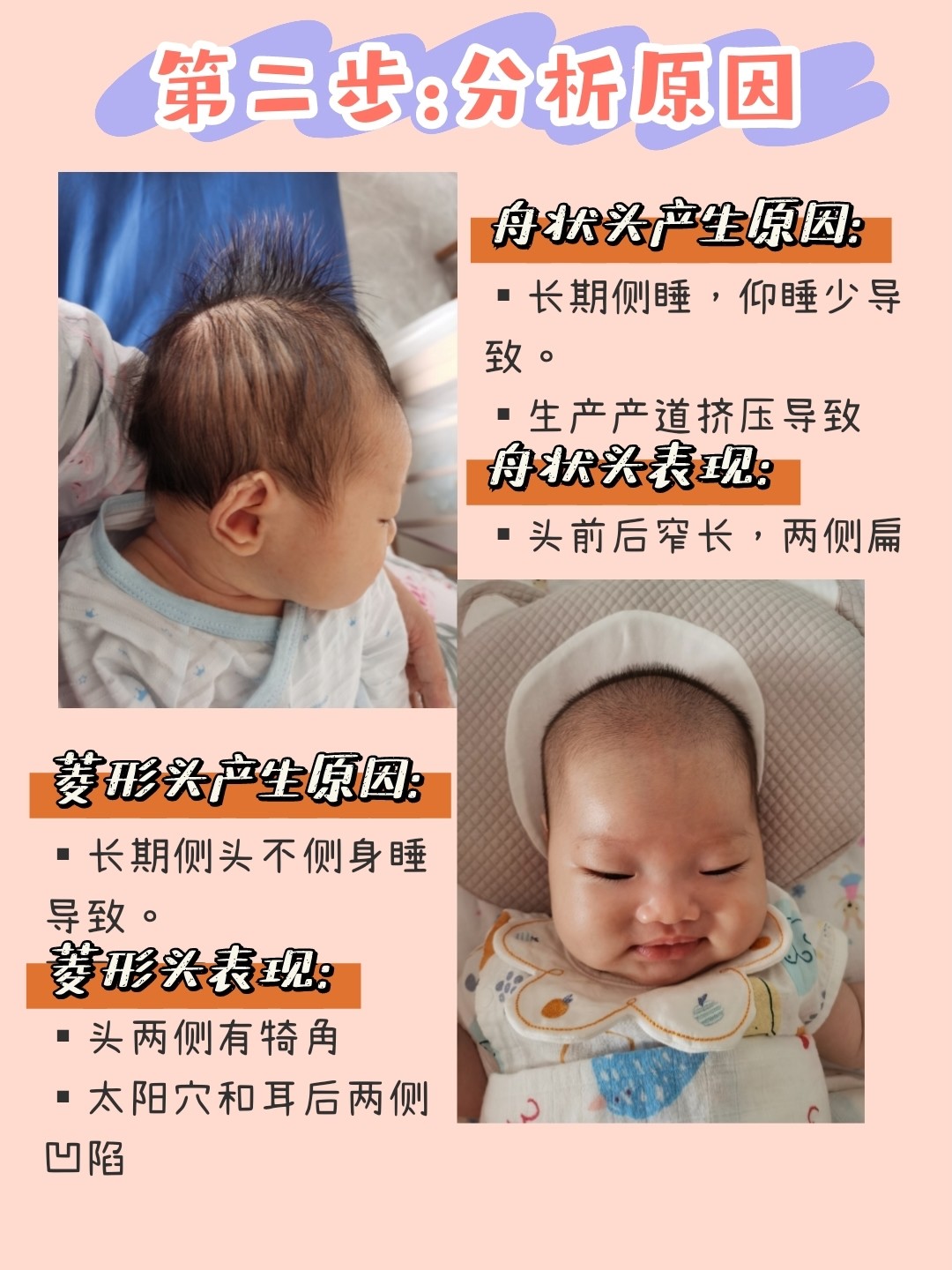 宝宝头型矫正|舟状菱形头矫正8个月变小圆头!