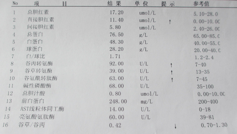 正常的肝功能报告单图图片