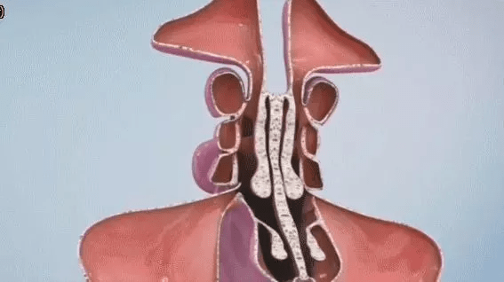 鼻竇解剖因素:由於各個鼻竇特殊的或異常的解剖構造,不利於通氣引流