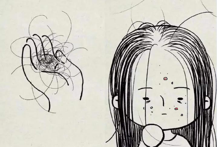 人生最悲哀的事不仅长痘还脱发