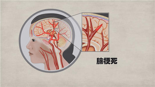 ef0e5717521346b18ba1a5e682a28eb5.png