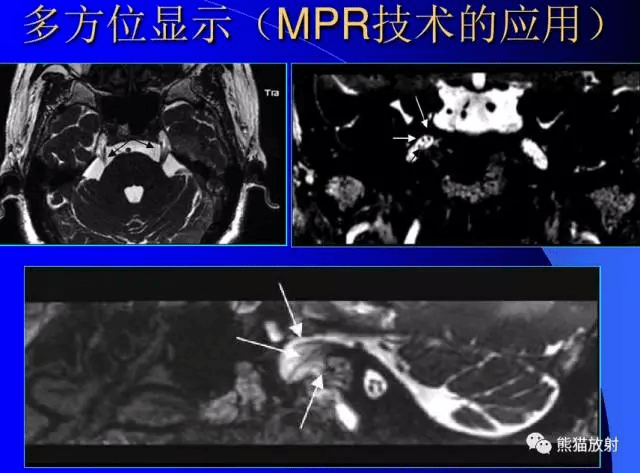 颅神经mri断层解剖