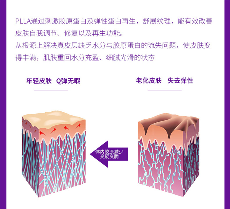 干细胞PLLA3D童颜素干细胞填充,plla聚左旋乳酸是什么？