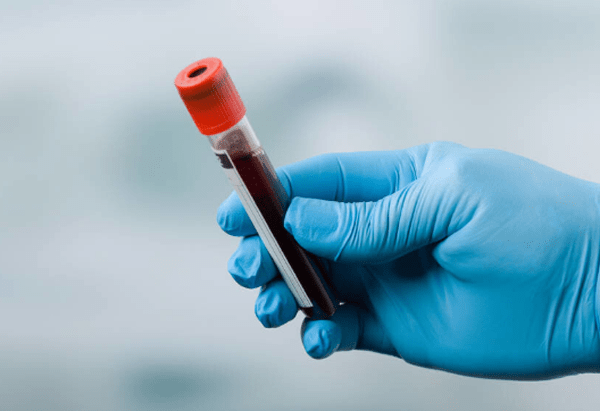 吃什么药降肌酐最好 519fe8283c47477d9f1b171fe18b94fb.png