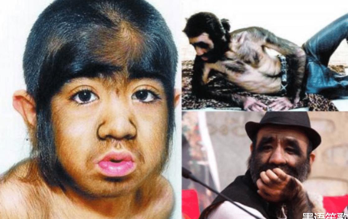 原创还记得那个轰动全国的毛孩于震寰吗已经44年过去他怎样了