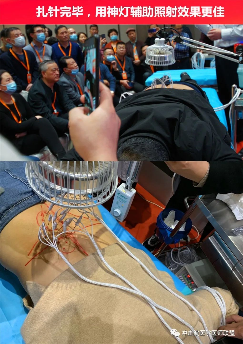 圆满闭幕99荣贺老师内热针专场凯思特99第五届特色专科门诊适宜