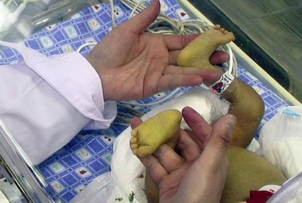 原创奶奶和姥姥给宝宝晒黄疸因晒姿走红网友真是煞费苦心