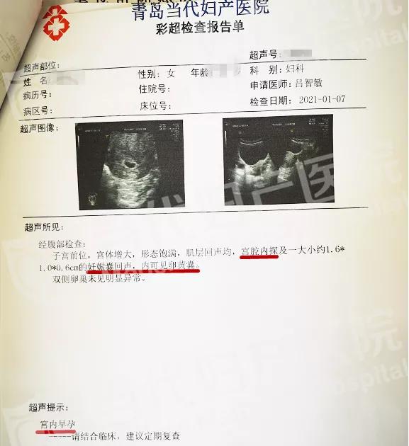 怀孕多久可以查出宫外孕还是宫内孕 421411e948b842d4b6bd845c4572c964.jpeg