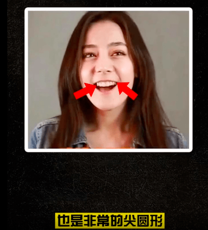 《长歌行》迪丽热巴颜值下滑,医生分析其颜值变化直言牙做坏导致颜崩