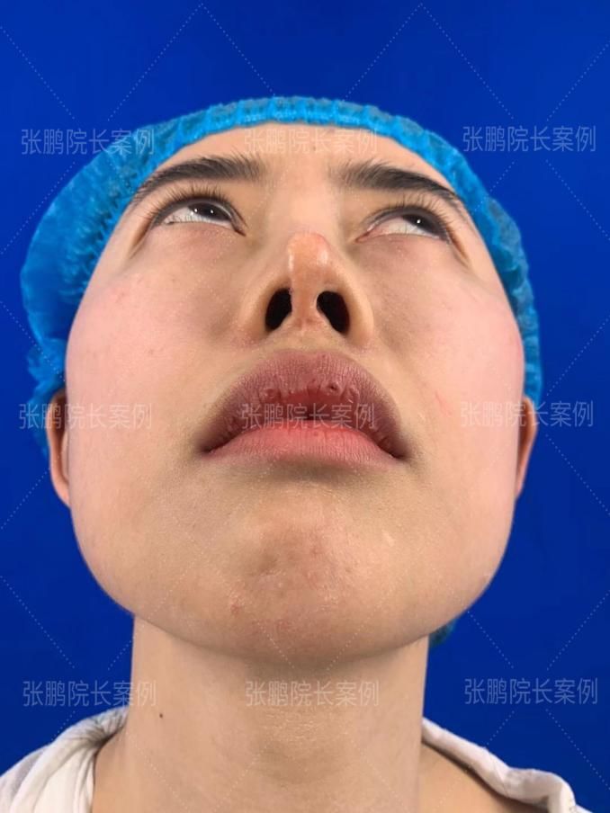 1dbb54c2e81148c5b7cba1f7e992ce3a.jpeg