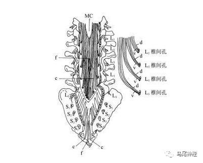 什么是马尾神经损伤?