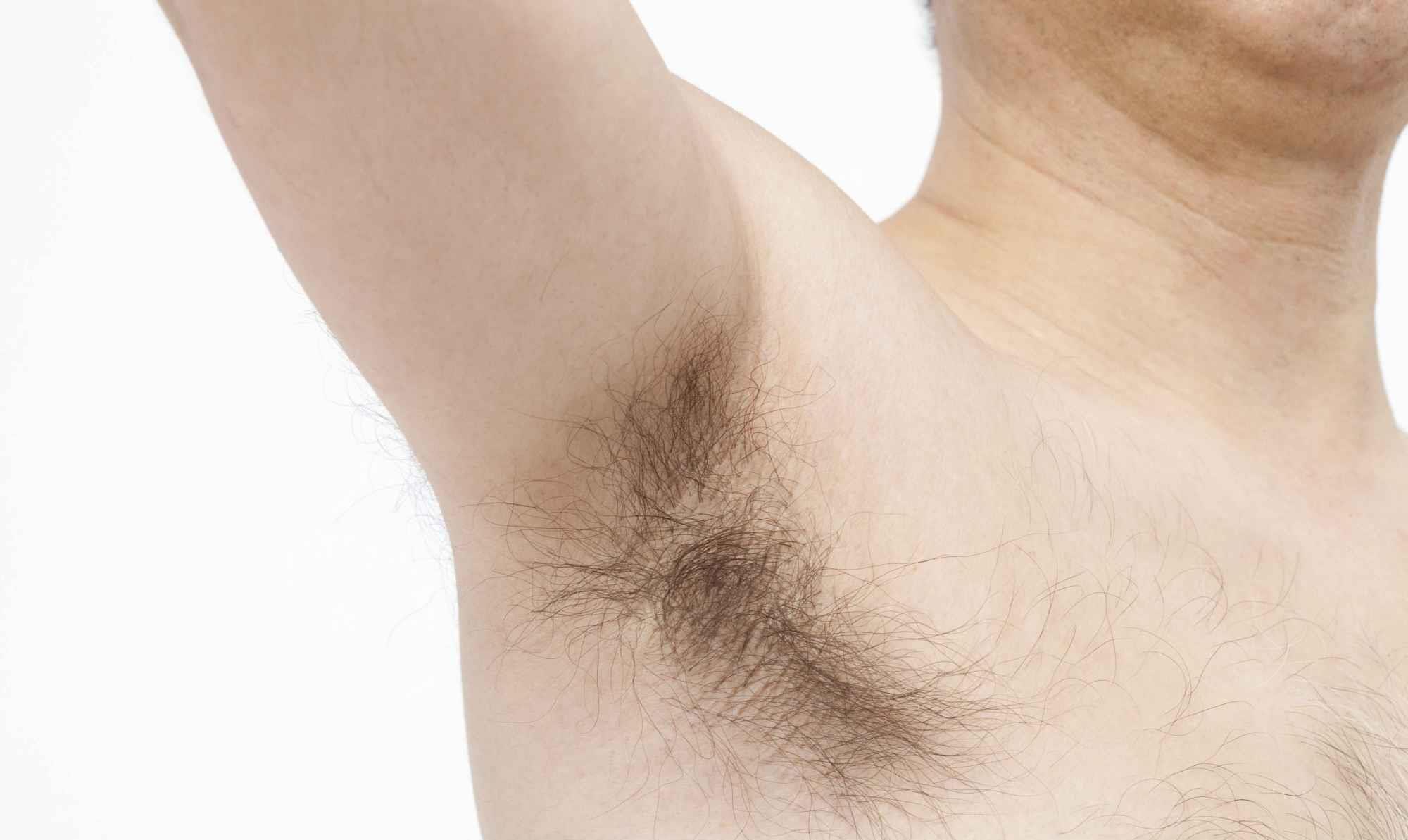 女性腋毛多好还是少好 提醒 腋毛过多过少可能都有问题