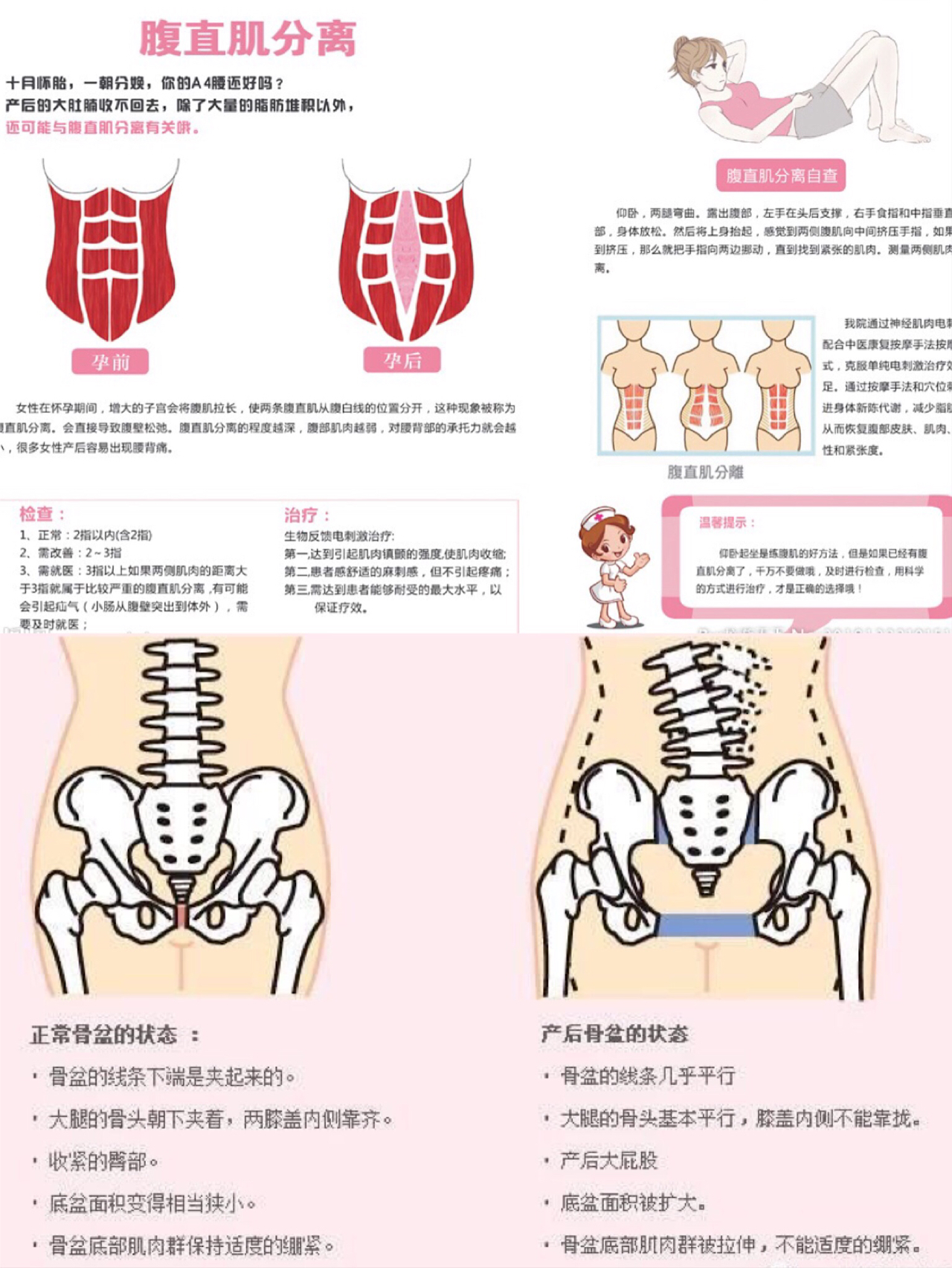 產後盆底肌修復乾貨二胎媽媽沒在怕