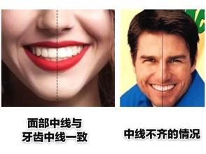 整齐的牙齿标准图片 b98a38b766074f07a8450a66585b6a69.jpeg