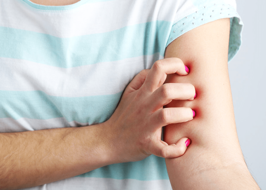 提醒女人 身上2处频繁 发痒 不一定是过敏 可能是hpv捣乱 病毒