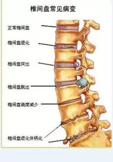 第十胸椎段:肾功能障碍,性功能障碍,易倦,干藓