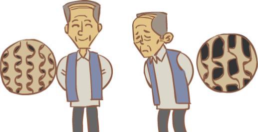 骨质疏松多走路可以吗 b54e66c186e1438b886b4e0bd6b74d1d.jpeg