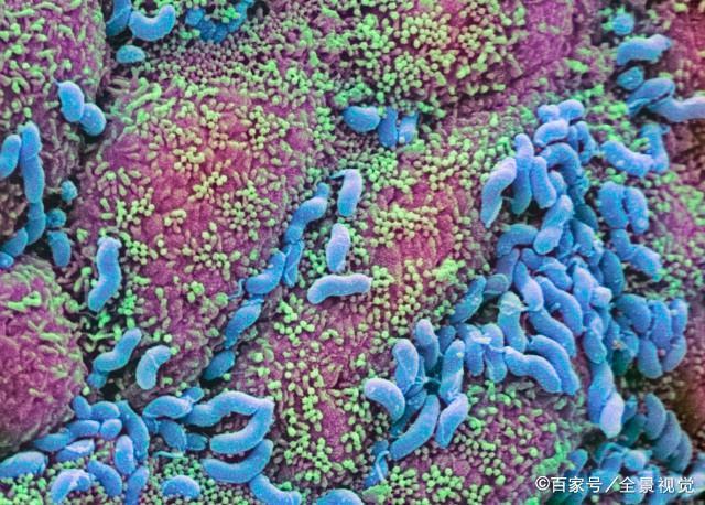 幽门螺杆菌超标,身上1处会臭,出现4个信号,胃已"千疮百孔"_传播