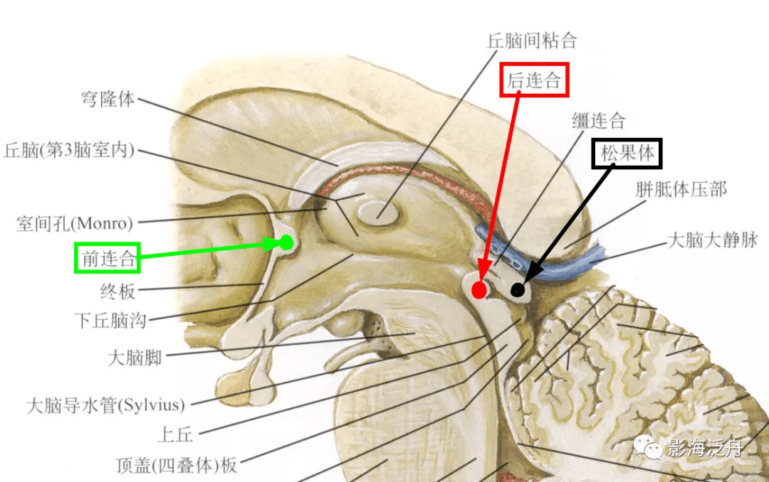 图上,尽管病灶和邻近脑实质的信号非常接近,但如果熟悉松果体区的解剖