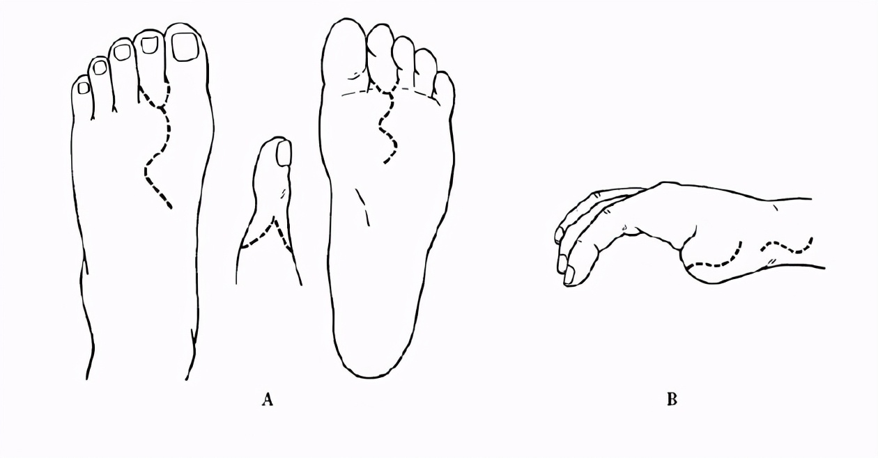 按摩大脚趾的正确方法（按摩脚趾的正确手法图）