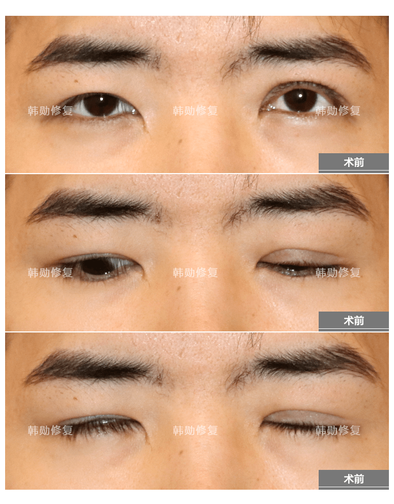 纹哪种眉毛好看又自然保持时间长 b59761ee10bf4e2487a5af2290de06db.png