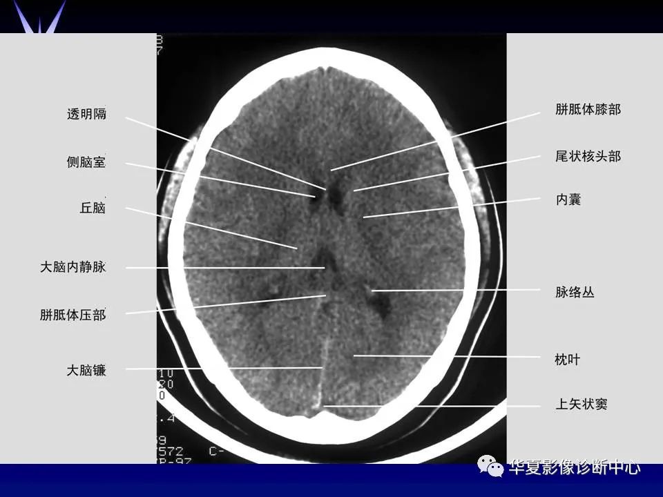 颅脑解剖ppt课件分享