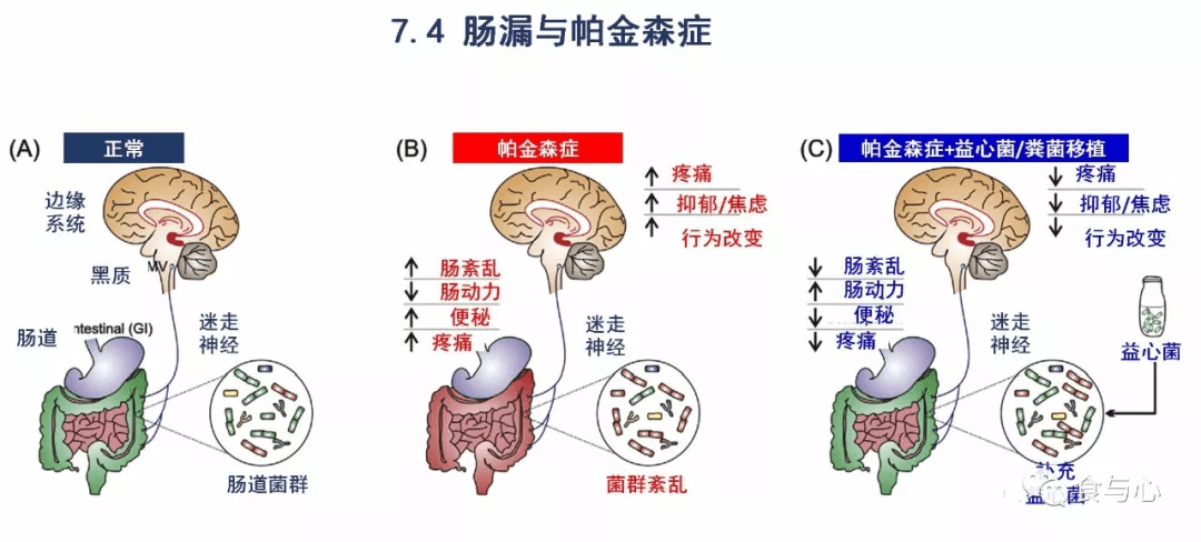 为什么肠瘘