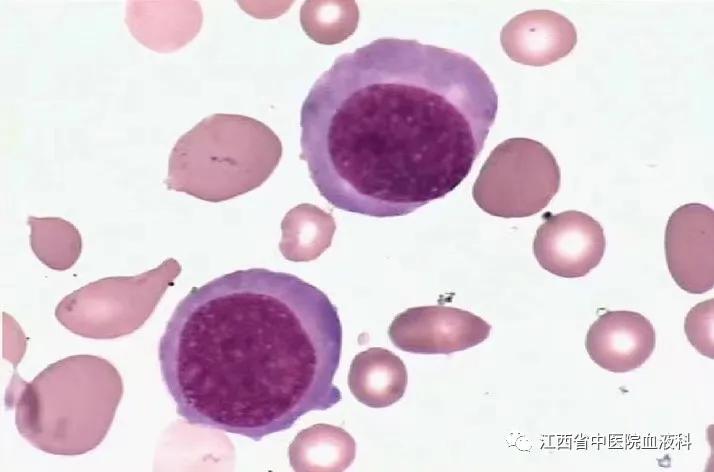 贫血是看哪个细胞 13fab4a9c0434e57b3e0534a8ace7e51.jpeg