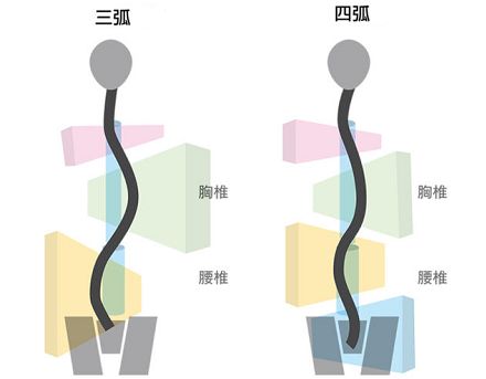 有脊柱侧弯,康复运动可以怎么做?