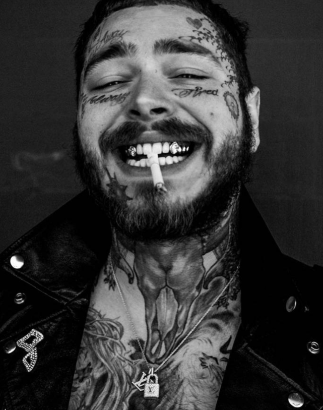 美国歌手镶1千万钻石牙,还有人额头镶1.5亿粉钻成幻视