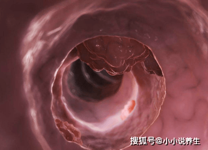 11892cf6b13540fdb356269fa63ee2e0.png