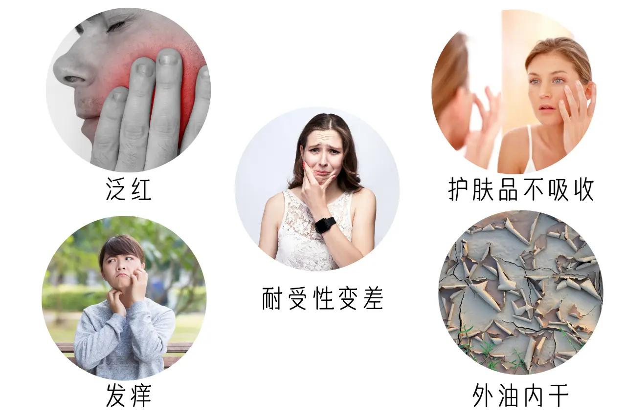 moodrose蒙蒂罗兰带你1分钟看懂皮肤屏障