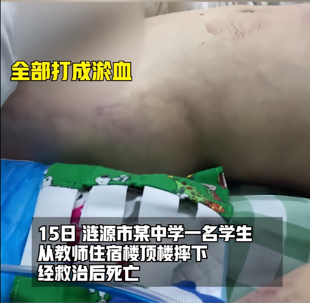 湖南一名中学生在校内坠亡,家属:孩子身上有被打的痕迹
