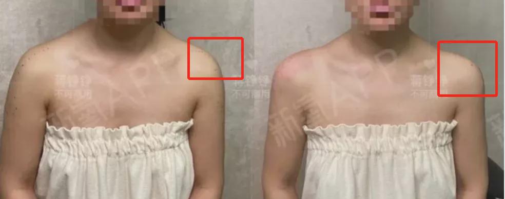 鞠婧祎|鞠婧祎对自己的肩膀到底做了什么？