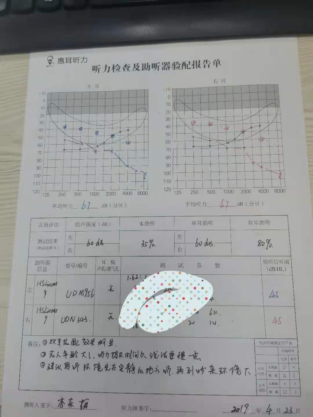 做纯音检查结果如下 三,根据检查报告推断为:感音神经性