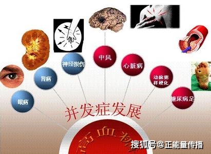 脚尖|血糖高不高，“脚部”先知？脚部这6种“症状”，希望你一个不占