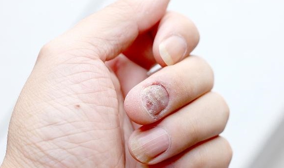 严重|肝病一般是“拖”出来的,若你身体有5种症状,可要多多注意了