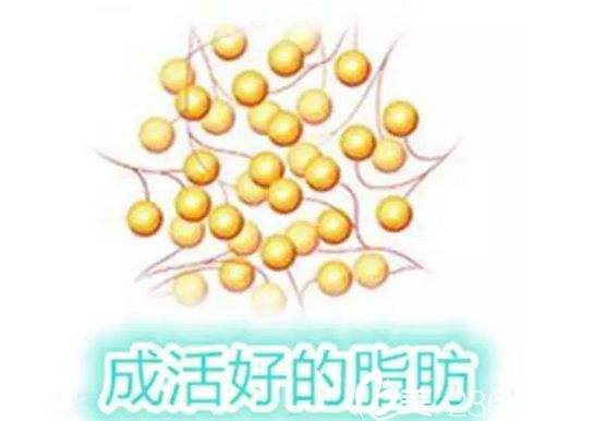 面部|自体脂肪填充面部多久恢复自然？反正闺蜜恢复挺快，真的变脸啦