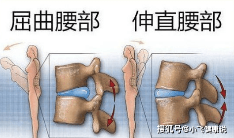 為什麼患有腰椎間盤突出症的人走路時十分困難但卻能騎自行車