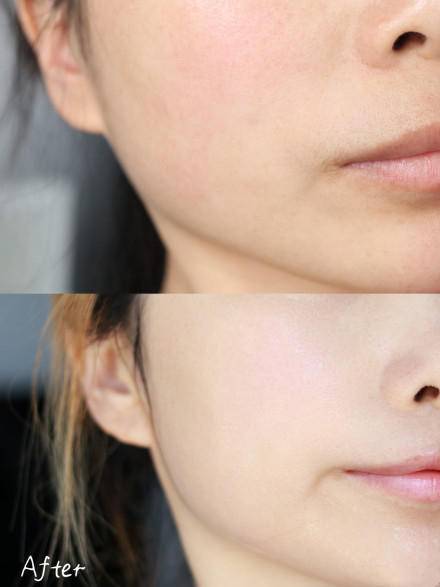 晒斑|这点没做好，脸上的斑肯定找上门