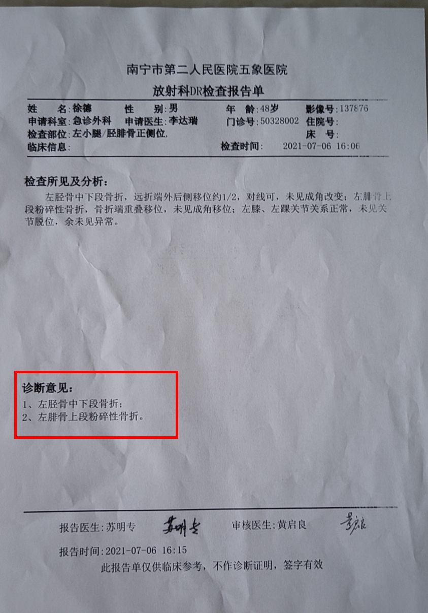 48岁的我不幸被重物砸伤导致左腿粉碎性骨折!