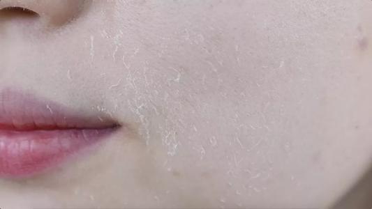 姐妹|水油平衡是什么?维持皮肤水油平衡的小妙招