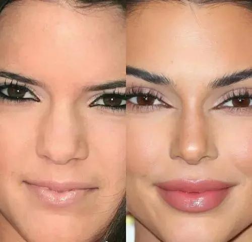 问题|给中年李嘉欣换上刘亦菲同款肉鼻头，会变什么样？