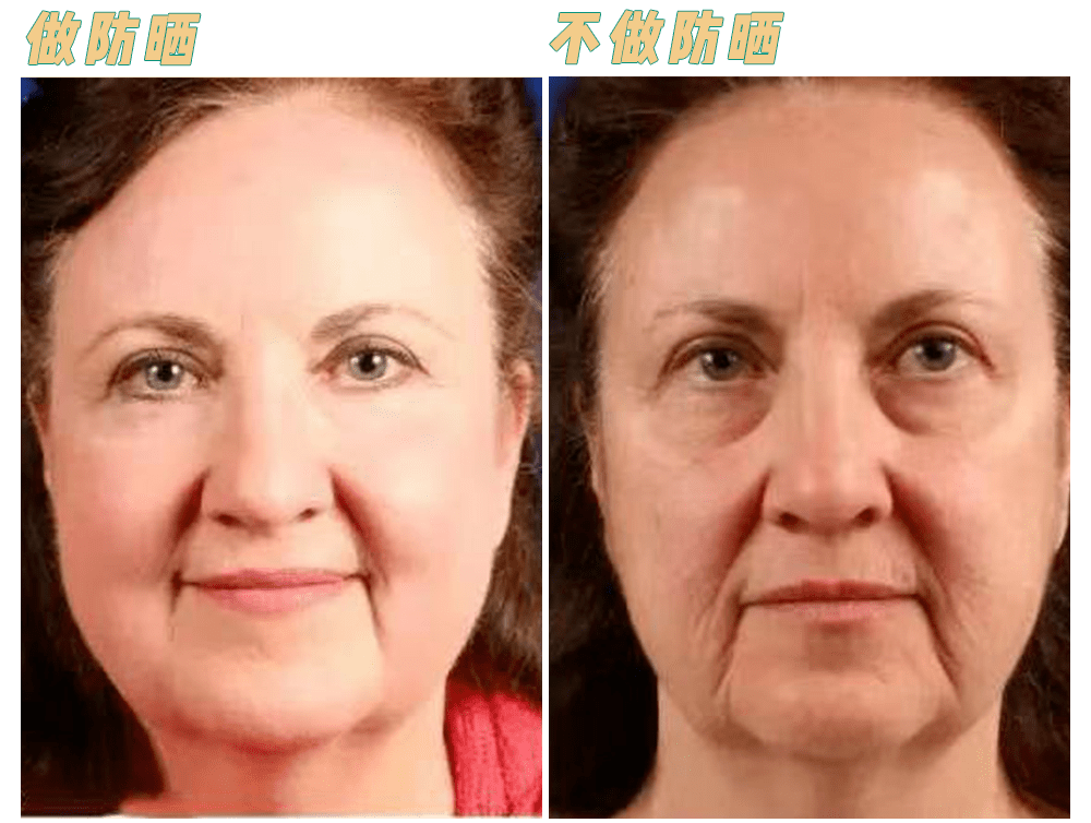 大部分|青晨采奕：这4个护肤误区，让你每天都是无效的护肤!