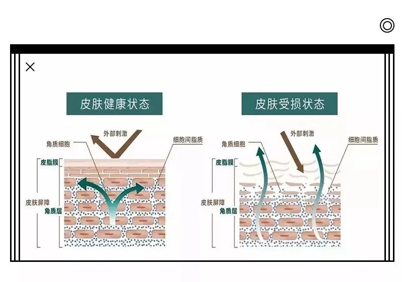 夏天|夏日护肤，如何保持肌肤水感？瑞可娜告诉你！