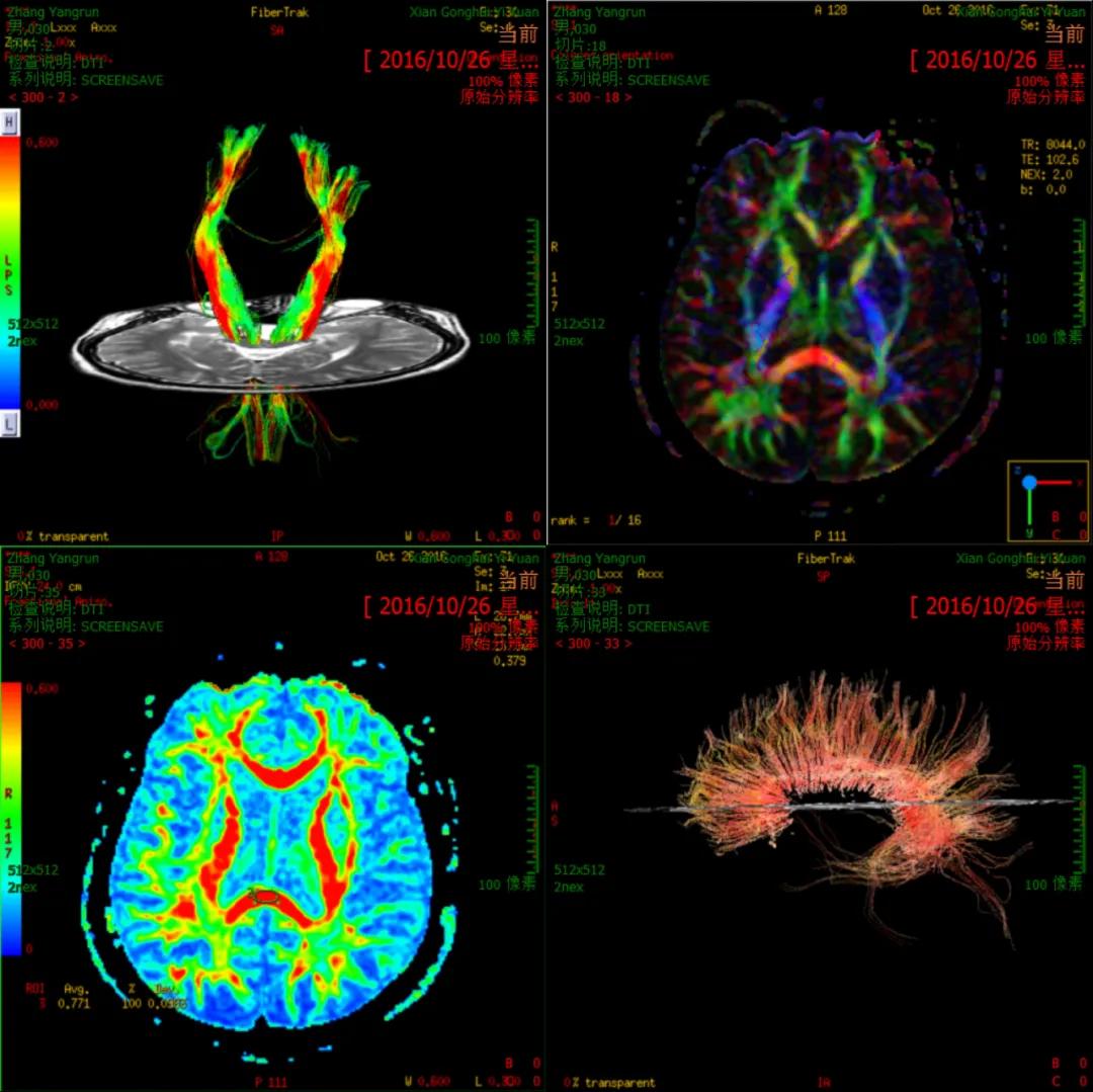 成像|【科室推荐】西安工会医院影像科