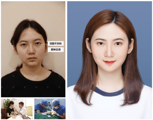 治疗|青春创造营活力开营！美莱五美实力演绎就敢这么美！